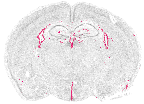 Coronal brain slice with the ependymal/glial cluster highlighted along the ventricle lining