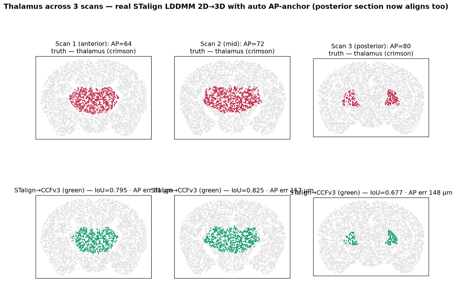 Two rows of three coronal scans: top shows ground-truth thalamus in crimson across anterior, mid, and posterior sections; bottom shows the thalamus recovered by STalign in green, including the posterior bilateral clusters